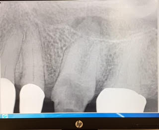 Bridge case of the day | Dr. Gentry