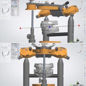dental implants computer design